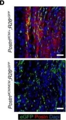 Immunohistochemistry: Periostin/OSF-2 Antibody - C-terminus - Azide and BSA Free [NBP1-30042]
